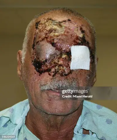 Poppo (pidgey) Là Gì? Hướng Dẫn Toàn Diện Về Pokemon Chim Đầu Tiên