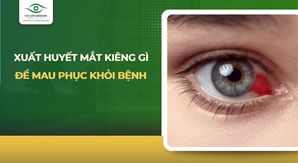 Câu đố kiến thức: Vitamin nào quan trọng cho sức khỏe của mắt?